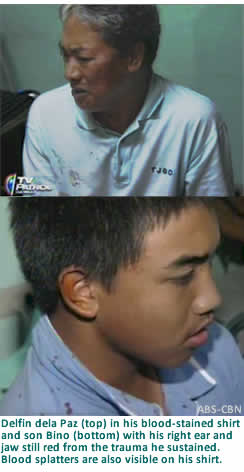 Delfin dela Paz (top) in his blood-stained shirt and son Bino (bottom) with his right ear and jaw still red from the trauma he sustained. Blood splatters are also visible on his shirt.