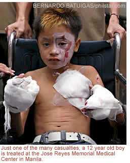 Just one of the many casualties, a 12 year old boy is treated at the Jose Reyes Memorial Medical Center in Manila